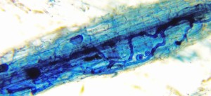 Elm-mycorrhiza-2