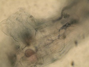 AM-vesicle+hyphae in turf roots
