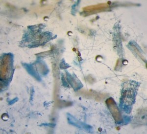 Glomus spores and root fragments