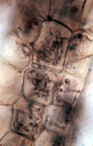 Ericoid mycorrhiza in Vaccinium deliciosum
