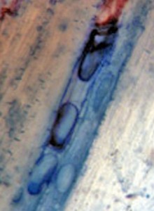AM- Ectomycorrhizae on Douglas-fir